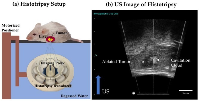 tumor-2.jpg