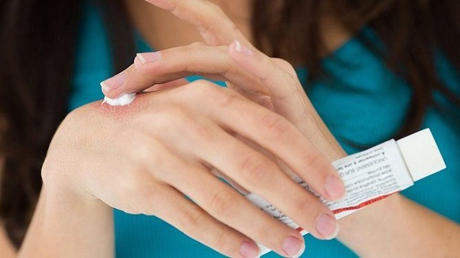 بهترین راهکارهای درمان اگزمای پوستی