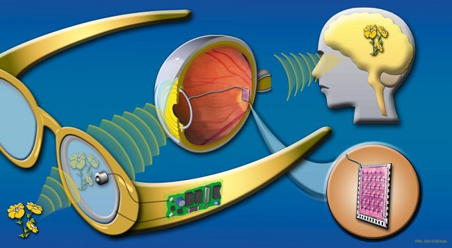 چشم بیونیک Science Eye بازیابی بینایی را به همراه دارد