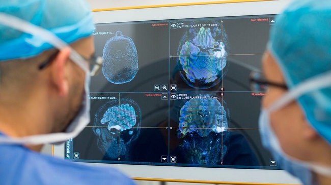 ابزار هوش مصنوعی به کمک تومور مغزی آمد