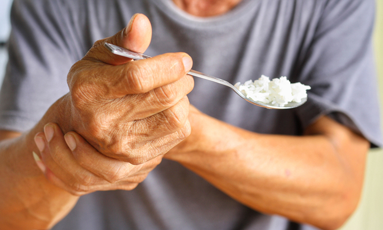 تشخیص زود هنگام بیماری پارکینسون با ساعت هوشمند