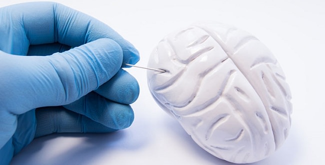 ابزار هوش مصنوعی به کمک تومور مغزی آمد