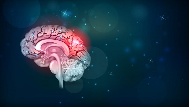 امید به بهبود بیماران سکته مغزی