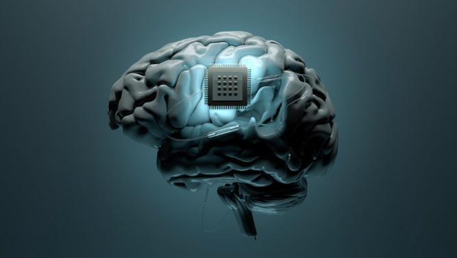 موفقیت شرکت Precision Neuroscience در کاشت تراشه روی مغز انسان