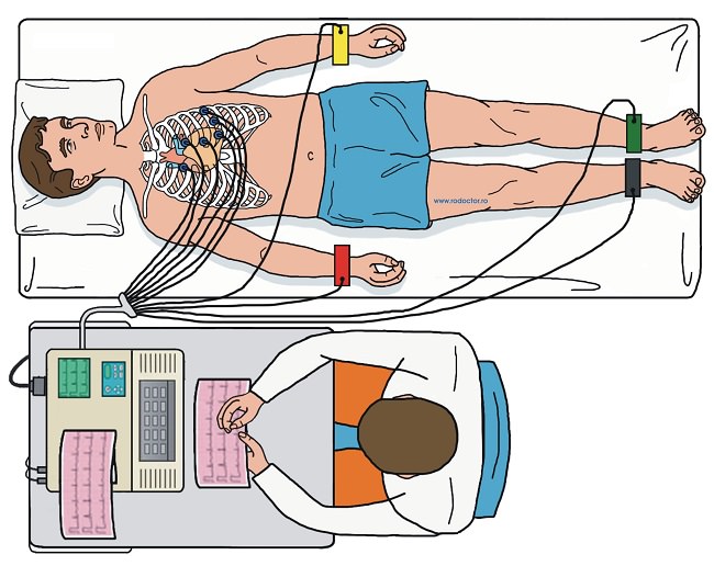 روش سنتی ثبت ECG