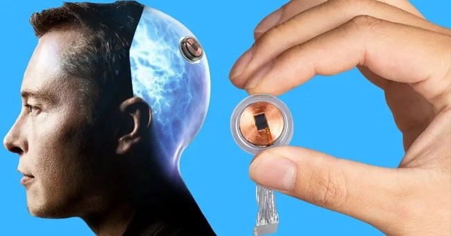 نورالینک (Neuralink)