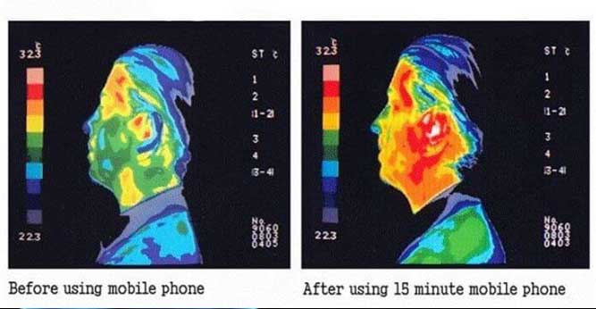 اثر استفاده از گوشی رو سر