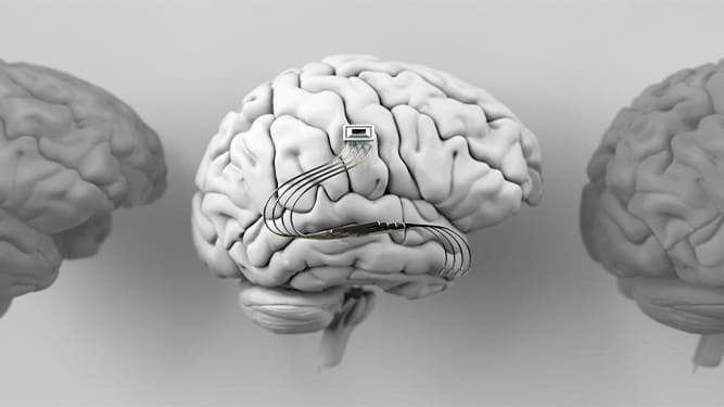 نسل جدید ایمپلنت‌های مغزی بی‌سیم
