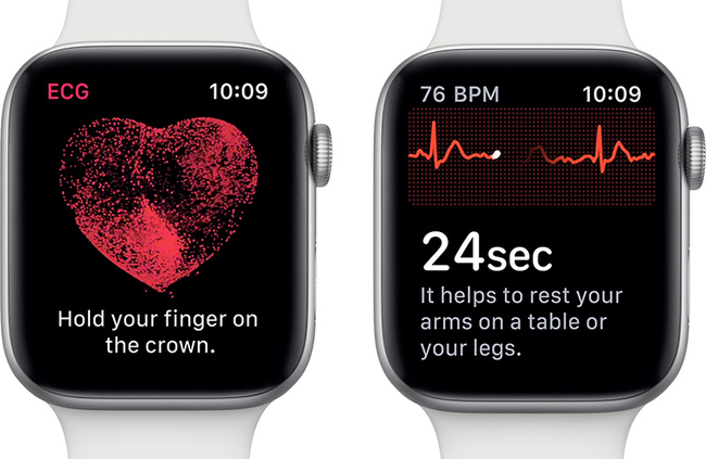 applewatch-ecg-intro.jpg